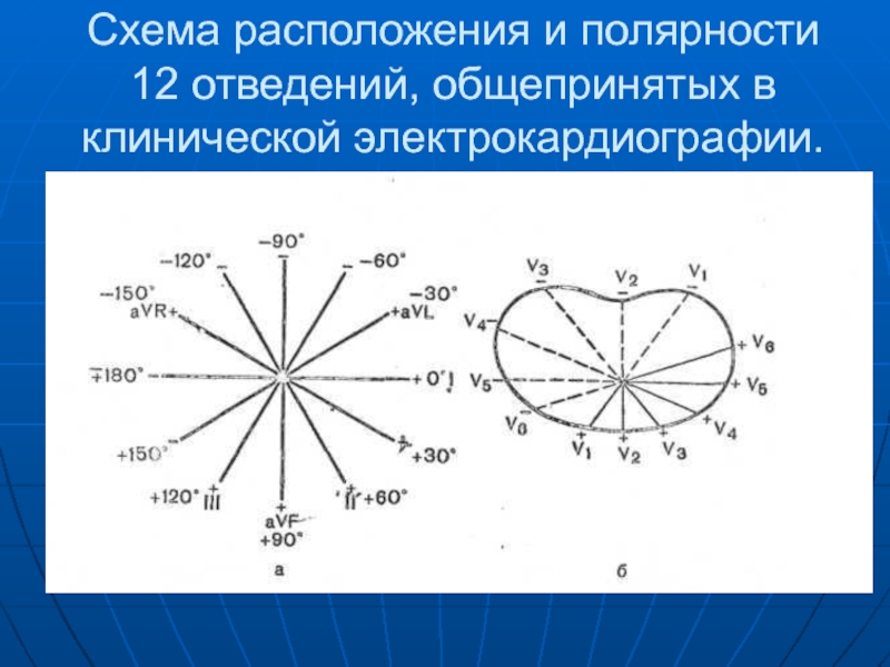 12 отведений экг схема