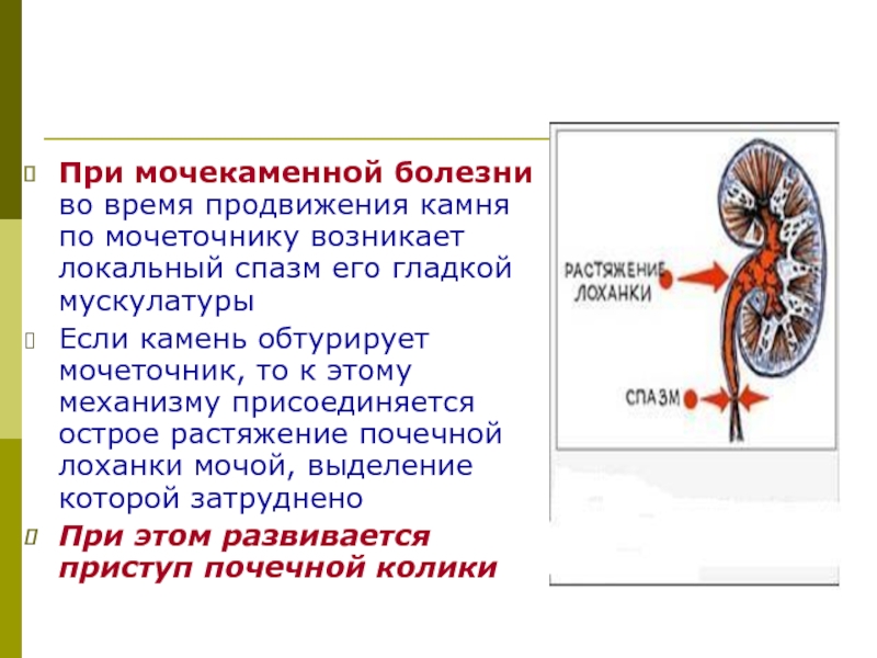 Мочекаменная болезнь карта вызова локальный статус