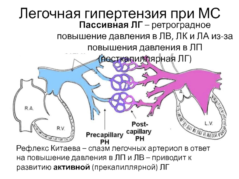 Легочная гипертензия что