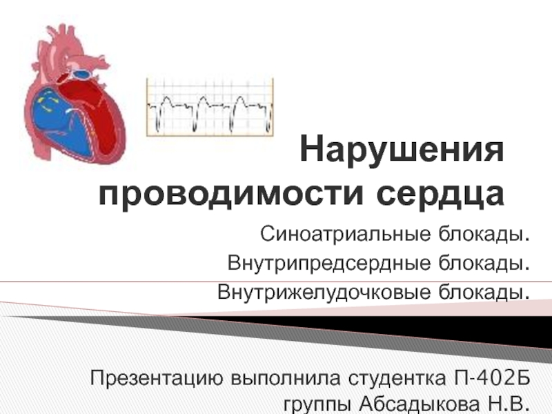 Презентация Нарушения проводимости сердца