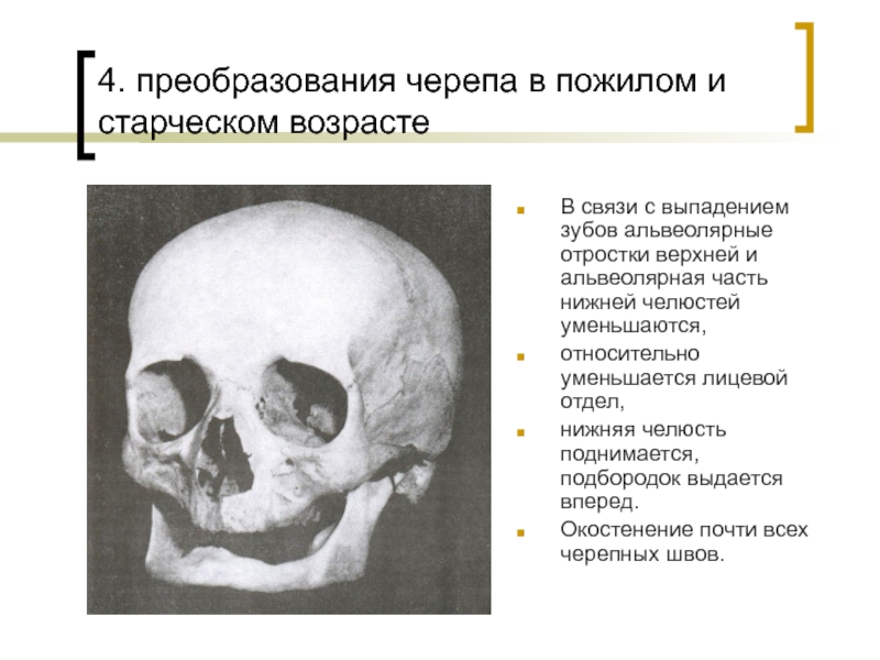 Костные ткани черепа. Возрастные изменения костей лицевого скелета. Возрастные изменения костей черепа. Возрастные изменения черепа анатомия. Старческие изменения костей черепа.