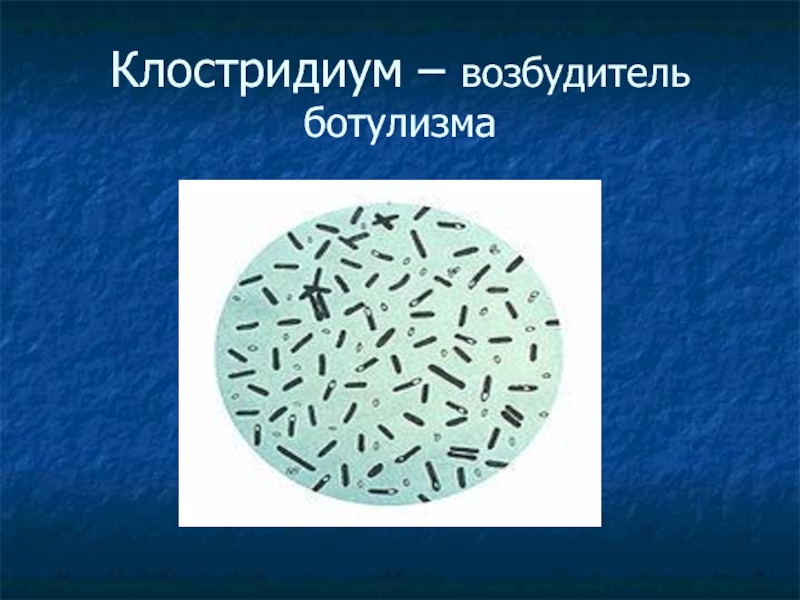 Кластридии. Клостридия ботулинум. Бактерии клостридии ботулизма. Клостридиум ботулинум микробиология. Clostridium botulinum микроскоп.