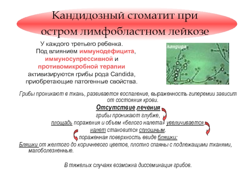 Анализы при стоматите. Стоматит и анализ крови. Кандидозный стоматит кандидозный. Проявления кандидозного стоматита. Кандидозный стоматит этиология.