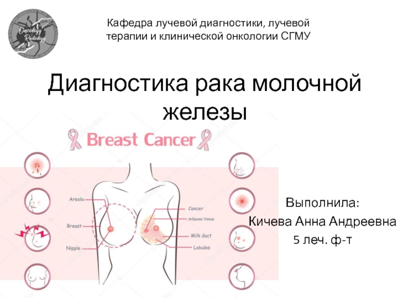 Диагностика рака молочной железы