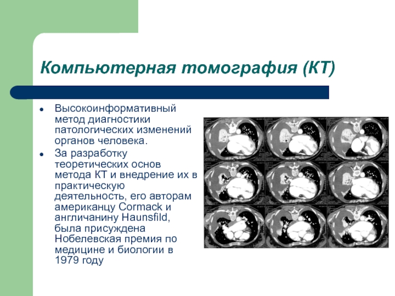 Компьютерная томография презентация