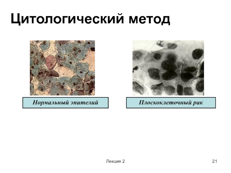 Цитологический метод презентация