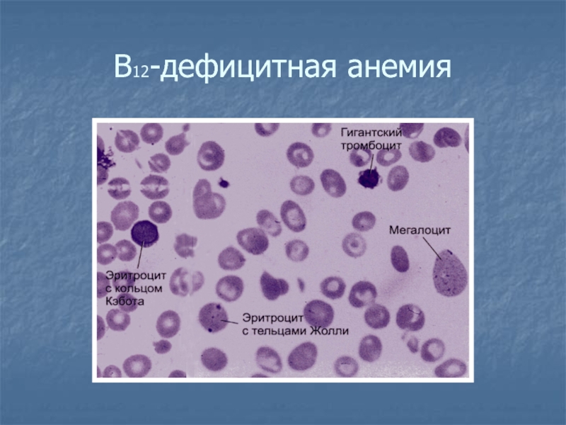 Патология системы крови презентация