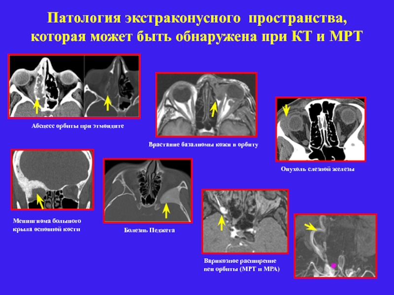 Лучевая диагностика заболеваний головы и шеи презентация