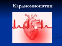 Кардиомиопатии