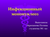 Инфекционный мононуклеоз