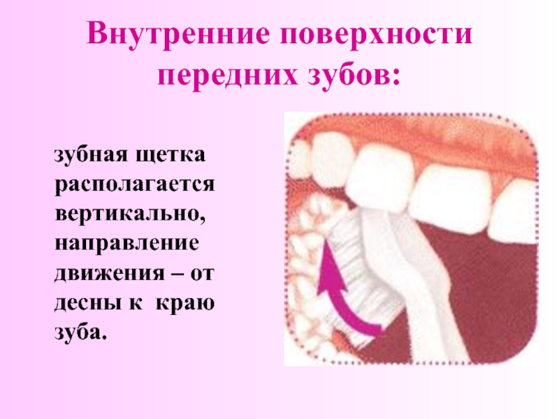 Внутренние поверхности передних зубов:  зубная щетка располагается вертикально, направление движения – от десны к краю зуба.