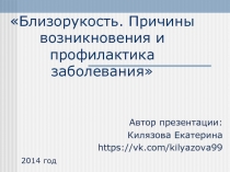 Близорукость. Причины возникновения и профилактика заболевания