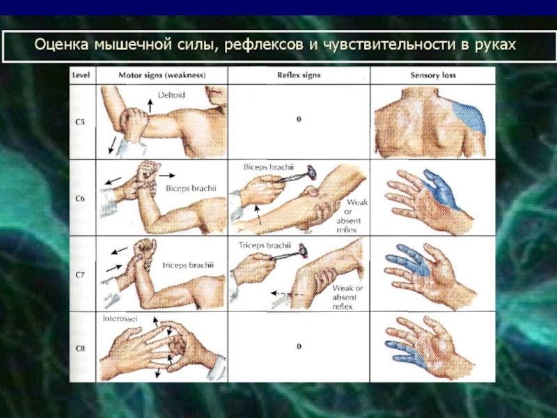 Парализовать движение. Мышечные рефлексы. Оценка мышечной силы. Оценка рефлексов в баллах. Баллы при парезе конечностей.