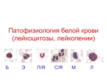Патофизиология белой крови (лейкоцитозы, лейкопении