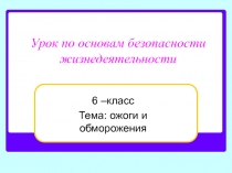 Обморожения и ожоги