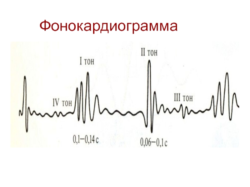 4 тон. Фонокардиограмма. Нормальная фонокардиограмма. Фонокардиограмма у здорового человека. Фонокардиограмма физиология.