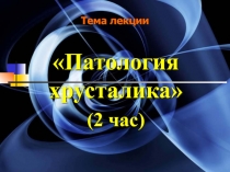 Заболевания хрусталика