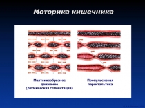Моторика кишечника