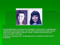 Зубочелюстные аномалии