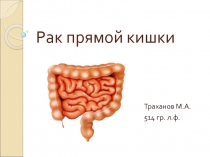 Рак прямой кишки