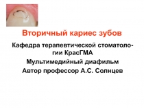 Вторичный кариес зубов