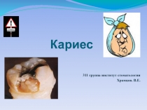 Кариес