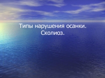 Типы осанки. Сколиоз 