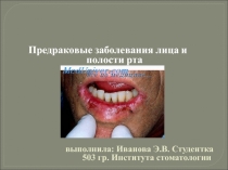 предраковые заболевания 