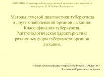 Классификация туберкулеза. Рентгенологическая характеристика различных форм туберкулеза