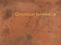 Опухоли яичников