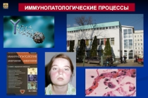 иммунопатологические процессы 