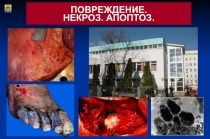 Повреждение некроз 