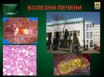 Болезни печени