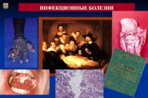Инфекционные болезни 