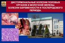 Дисгормональные болезни половых органов