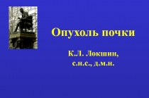 Опухоли почки