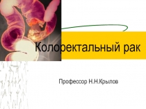 Рак ободочной кишки
