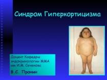 Заболевания надпочечников. Синдром гиперкортицизма