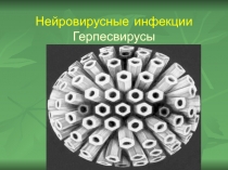 Нейровирусные инфекции Герпесвирусы