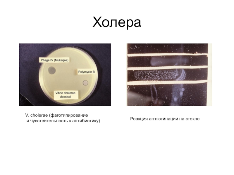 Холера V. сholerae (фаготипирование и чувствительность к антибиотику)Реакция агглютинации на стекле