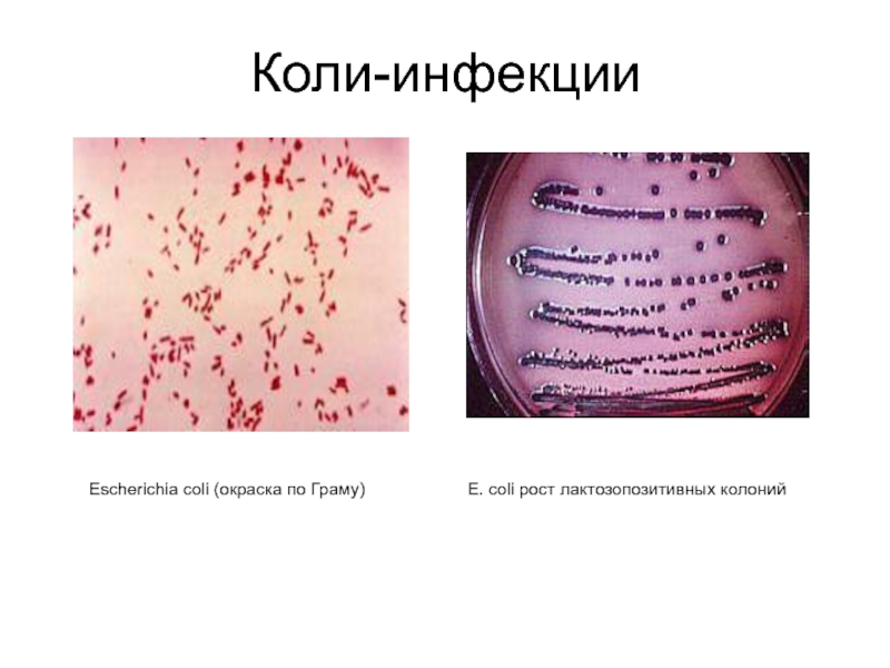 Коли-инфекцииEscherichia coli (окраска по Граму)E. coli рост лактозопозитивных колоний