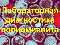 Лабораторная диагностика полиомиелита