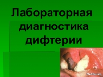 Лабораторная диагностика дифтерии