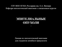 Эпителиальные опухоли