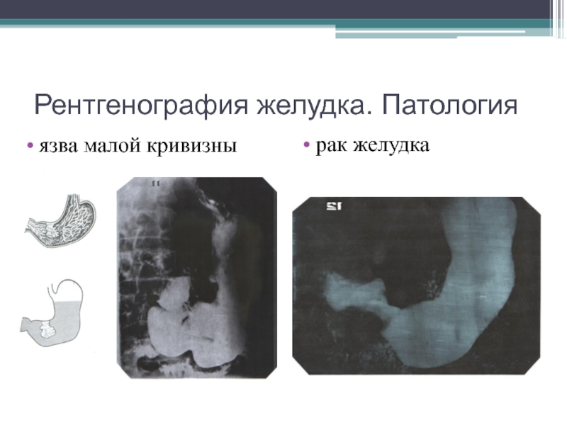 При рентгеноскопии изображение внутренних органов