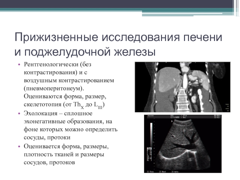 Исследование печени. Методы визуализации поджелудочной железы. Методы исследования поджелудочной железы. Обследование печени и поджелудочной железы. Лучевые методы визуализации поджелудочной железы.