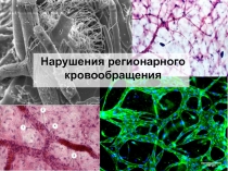 Нарушения регионарного кровообращения