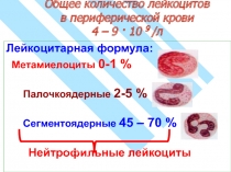 белая кровь