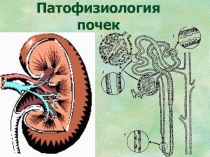 Патология почек 
