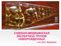 СУДЕБНО-МЕДИЦИНСКАЯ ЭКСПЕРТИЗА ТРУПОВ НОВОРОЖДЕННЫХ